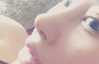 鼻翼缩小手术后应注意的事项