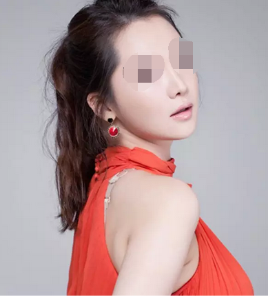 宁波做鼻翼缩小哪里做的好