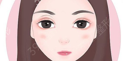 广州紫馨双眼皮修复*_术后真实案例反馈_价格明细查询