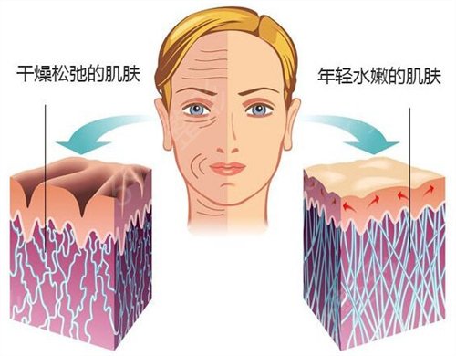 深圳哪里做拉皮手术好