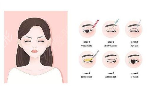 长沙做双眼皮整形医院排名前十位
