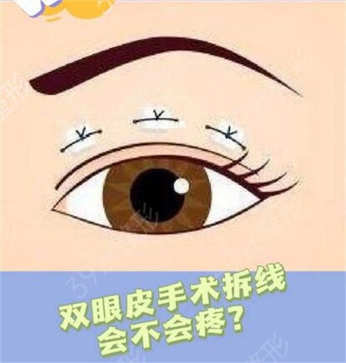 上海九院双眼皮修复专家是谁