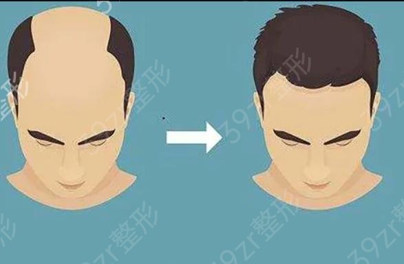 台州植发医院排名榜前三结果公布