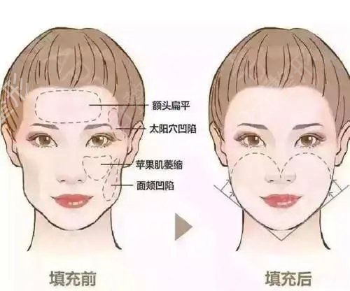 新的黑龙江整形医院排行前3名一览