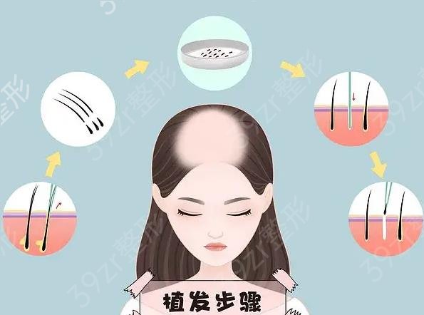 北京碧蓮盛和雍禾哪個(gè)好