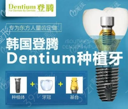 2022韩国进口种植牙品牌排名榜前五盘点_各种植体费用区间优先公布