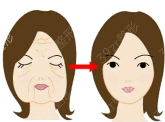 上海薇琳医疗美容医院热玛吉正规吗
