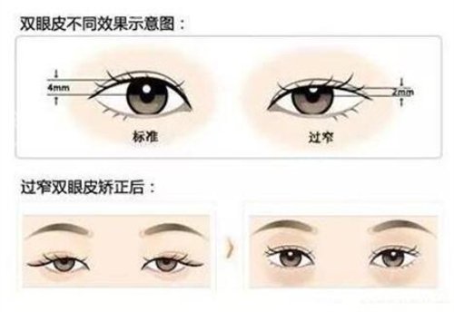 武汉医美整形医院排名榜4大知名机构揭晓