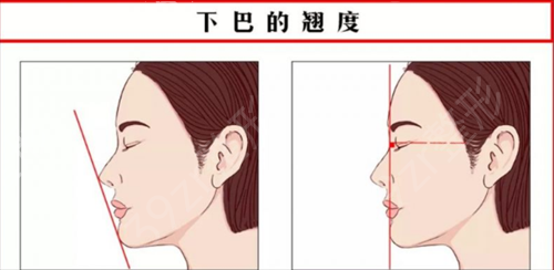 上海做下颌角医院排行榜全新对比