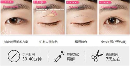 南昌做双眼皮哪家医院好