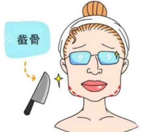 长沙下颌角磨骨哪家医院好