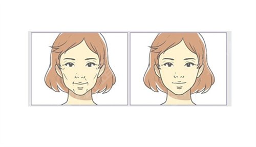 长沙做拉皮整形医院排行榜top3强
