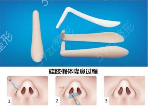 深圳哪里做鼻子好一点
