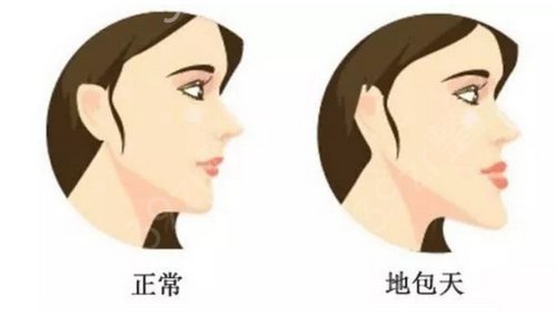 重庆新时代整形_发际线移植告别大额头