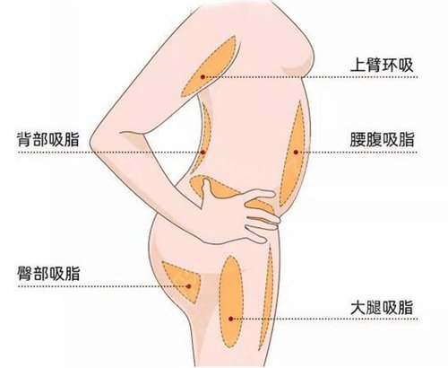 昆明整形医院排行榜2022版_内含吸脂案例果图