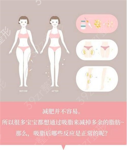 上海哪里抽脂比较好啊