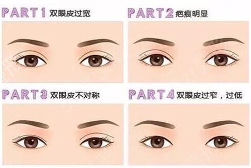郑州做双眼皮哪家医院专业好