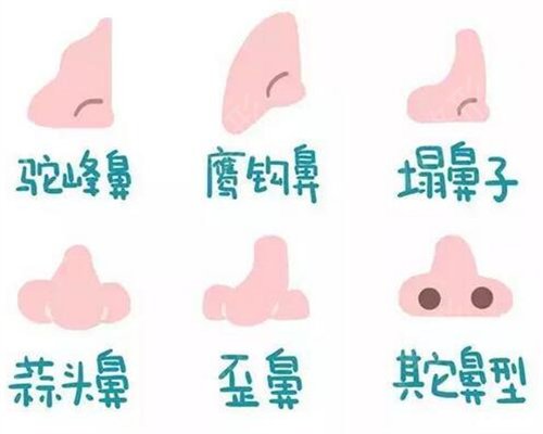 济南公立医院做隆鼻哪家好