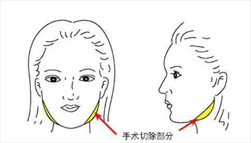 上海九院整形科專家排名