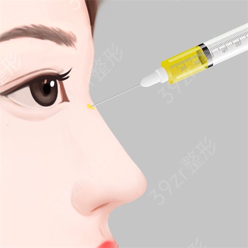杭州公立（三甲）医院整形科排名口碑推荐_擅长介绍及隆鼻案例一览