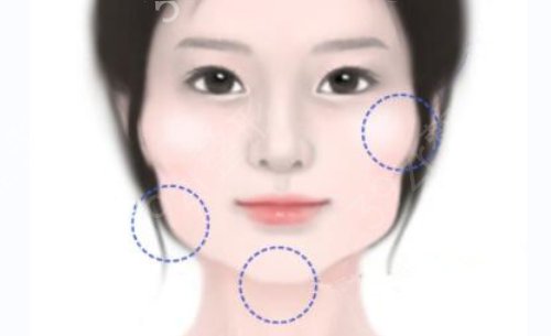 2022上海九院整形科磨骨医生排名、案例、价格等信息一一提供