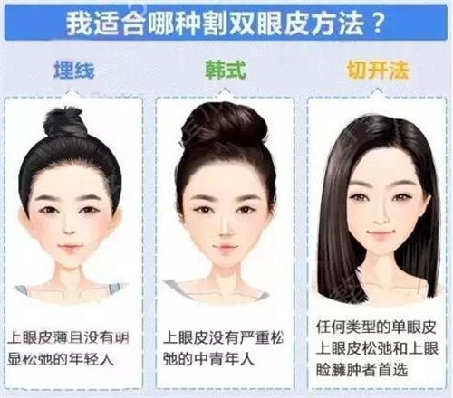 成都三甲双眼皮医院哪个好