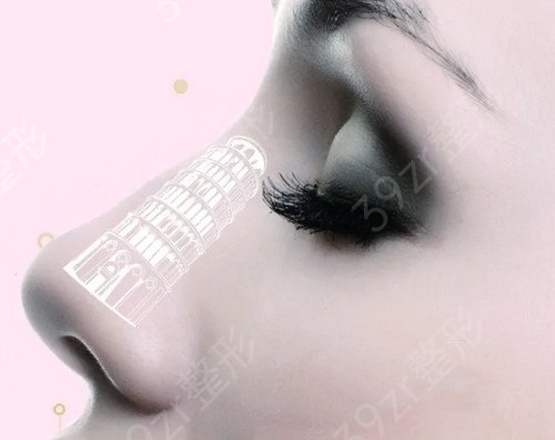 做鼻子选上海九院还是北京八大处
