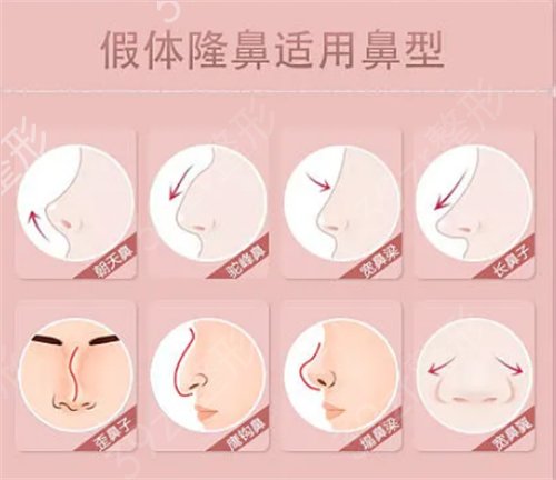 北京隆鼻修复厉害的医生有哪些