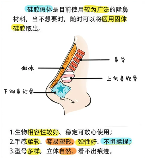 长沙隆鼻比较出名的医院前三名单