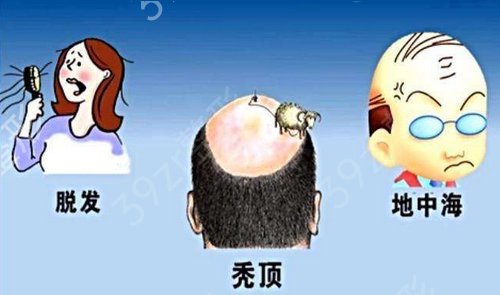 上海植发医院哪家医技术好