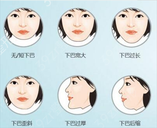 上海做下颌角医院排行榜全新对比