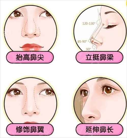 四川友谊医院整形科隆鼻怎么样