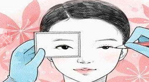 南充割双眼皮医院哪家好