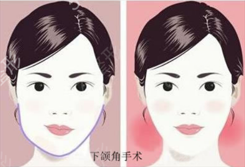 昆山市人民医院烧伤整形外科价格表2022