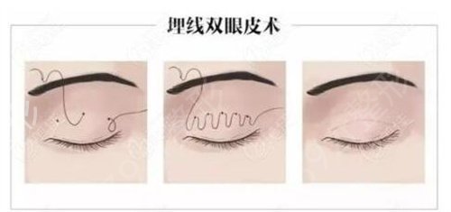 沈阳杏林和百嘉丽哪个医院好