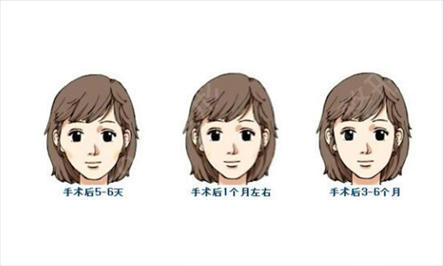 北京磨骨医院排前3名的都是谁