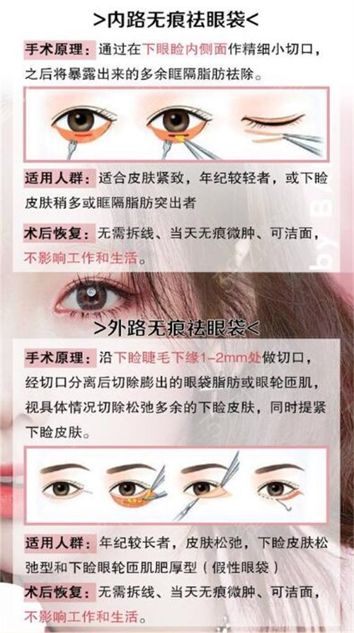 上海祛眼袋醫(yī)院哪家好