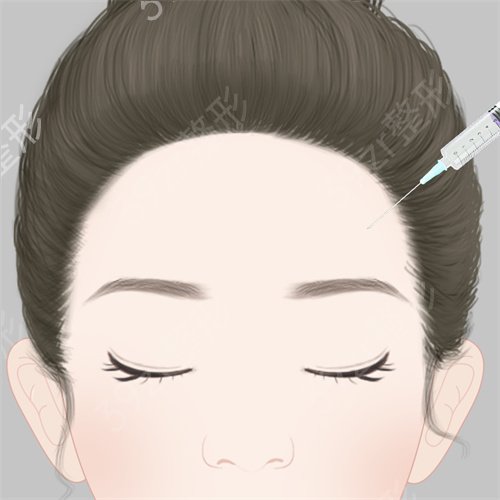 杭州豐太陽穴整形醫(yī)院排名前十