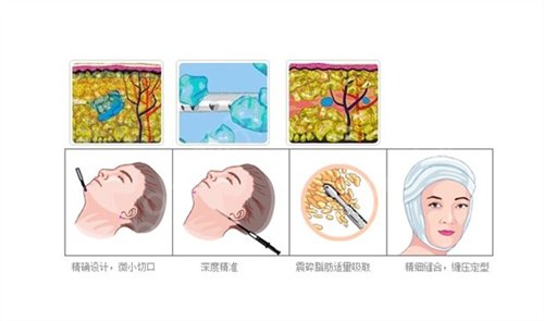 南京较好的整形公立医院哪家好