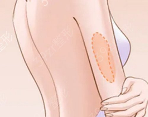 九院注射瘦肩要挂什么科