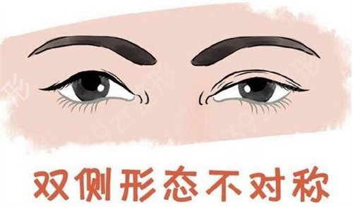 郑州做双眼皮哪家医院专业好