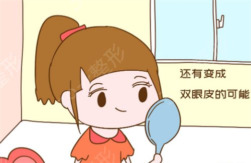 去延世整形医院做了双眼皮