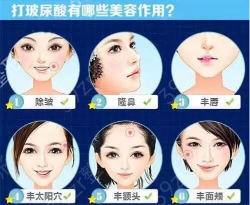 北京卓彦美容医院玻尿酸真人秀