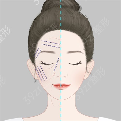 广州磨骨出名的专家当属这三位