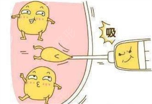 武汉医院希思特吸脂果怎么样