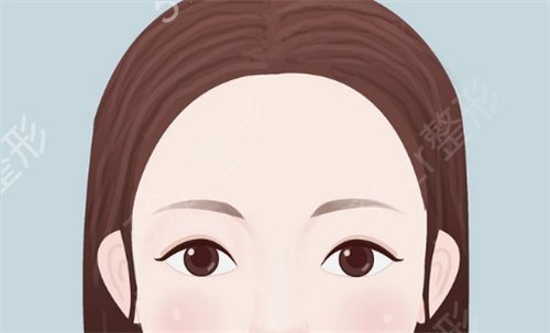 重庆新时代整形_发际线移植告别大额头