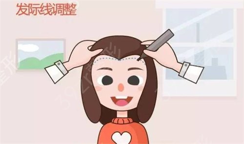 重庆新时代整形_发际线移植告别大额头