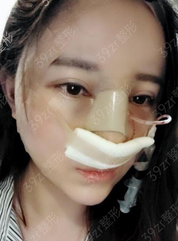 宁波隆鼻整形美容医院排名榜top10汇总
