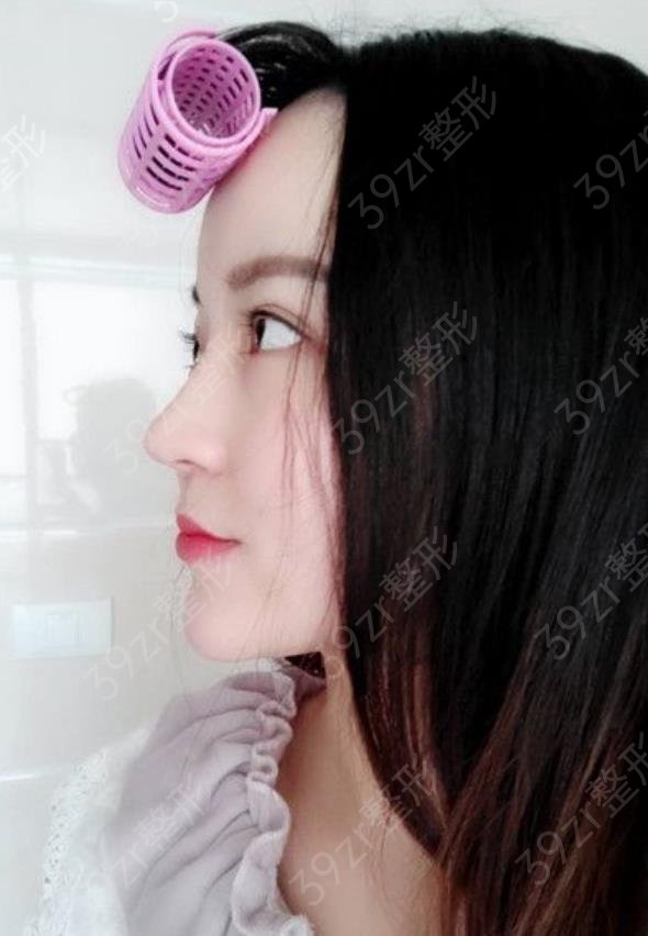 宁波隆鼻整形美容医院排名榜top10汇总