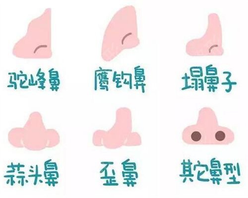上海有名气的鼻王哪个好